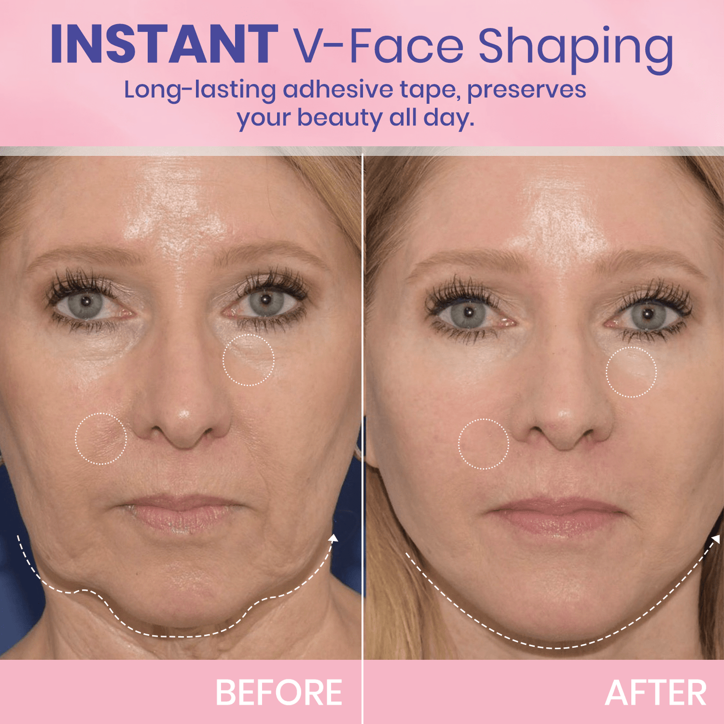 🎉NEW YEAR SALE - 50% OFF!🎁Give the Gift of Beauty in 2025 with BBOJI™ V-Face Tape for a Stunning Look.💄Hurry Now!🐰