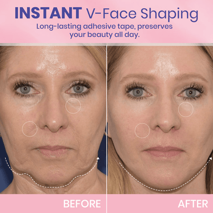 🎉NEW YEAR SALE - 50% OFF!🎁Give the Gift of Beauty in 2025 with BBOJI™ V-Face Tape for a Stunning Look.💄Hurry Now!🐰