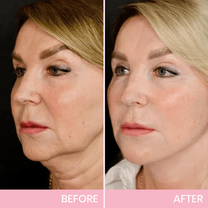 🎉NEW YEAR SALE - 50% OFF!🎁Give the Gift of Beauty in 2025 with BBOJI™ V-Face Tape for a Stunning Look.💄Hurry Now!🐰