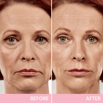 🎉NEW YEAR SALE - 50% OFF!🎁Give the Gift of Beauty in 2025 with BBOJI™ V-Face Tape for a Stunning Look.💄Hurry Now!🐰